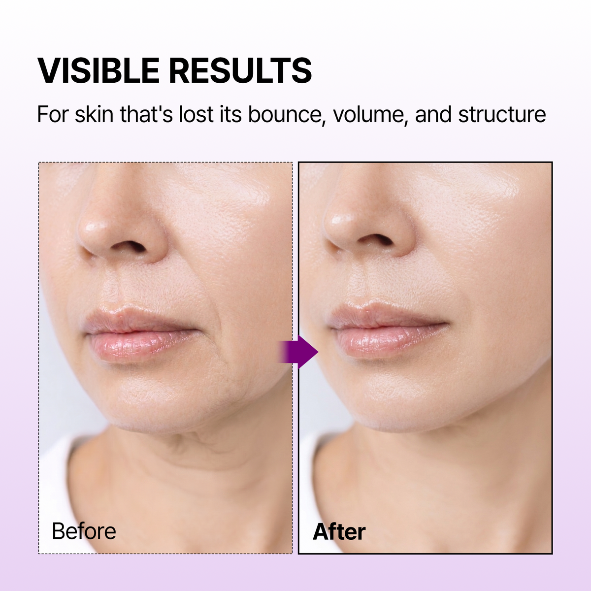 Calcium Bonding Facial Cream