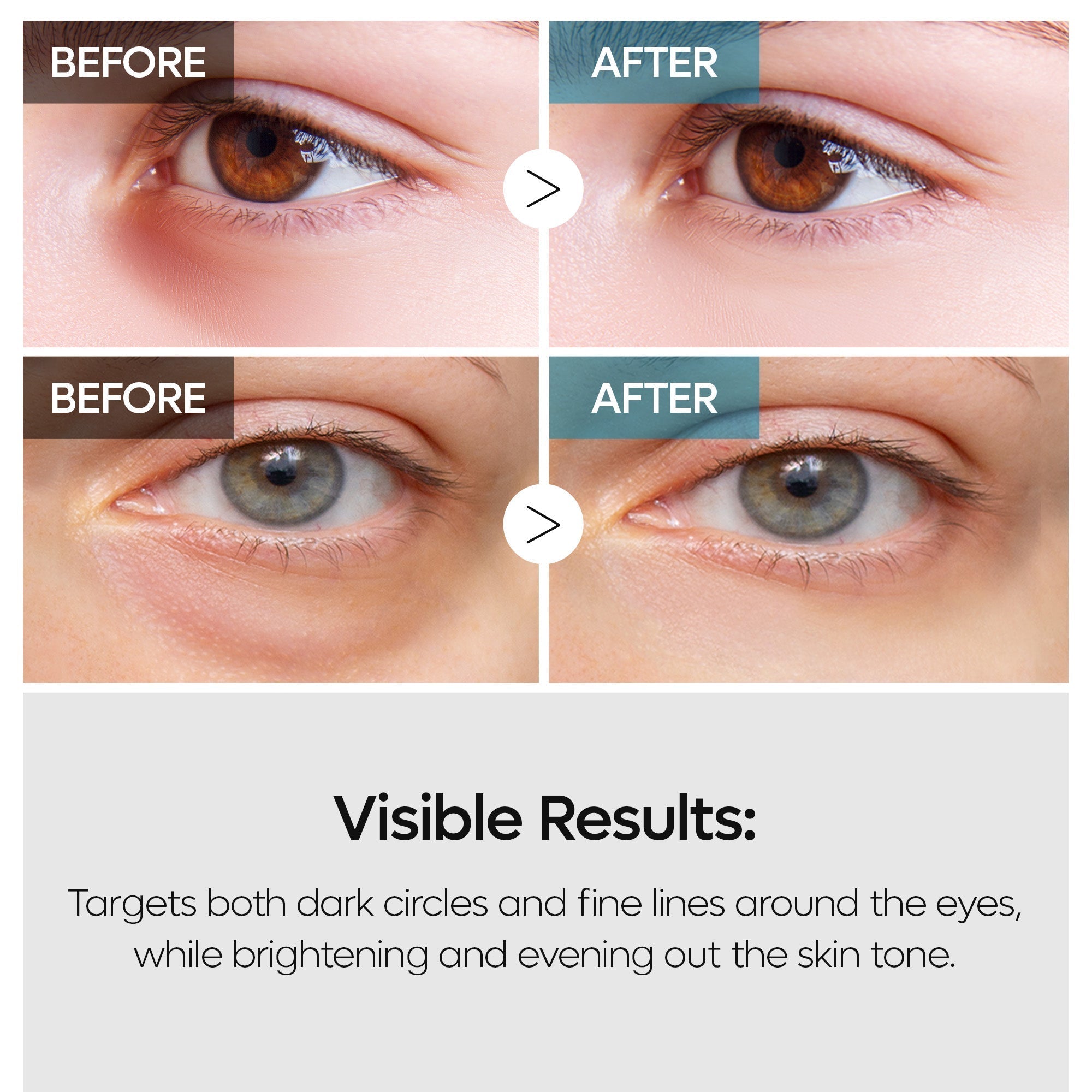 TX Retinalsome Eyecream 40g 1EA